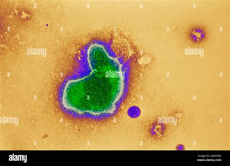 Respiratory Syncytial Virus Coloured Transmission Electron Micrograph