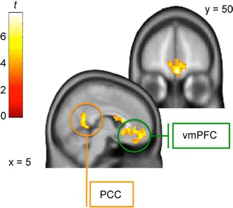 Interactions Between Dorsolateral And Ventromedial Prefrontal Cortex