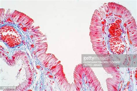 107 Simple Columnar Epithelium Stock Photos High Res Pictures And