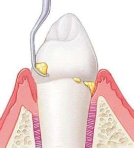 Procedimentos periodontais WR Instituto Odontológico