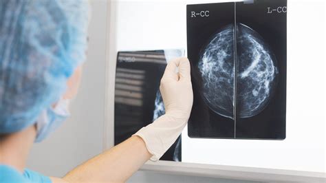 AI Outperforms Doctors Diagnosing Breast Cancer BBC News