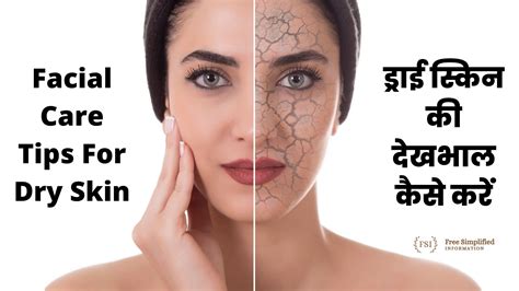 ड्राई स्किन की देखभाल कैसे करें Facial Care Tips For Dry Skin In Hindi