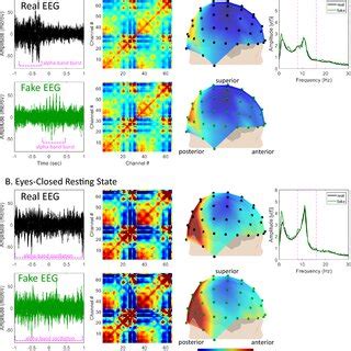 Examples Of Eye Open A And Eyes Closed B Resting State EEG For