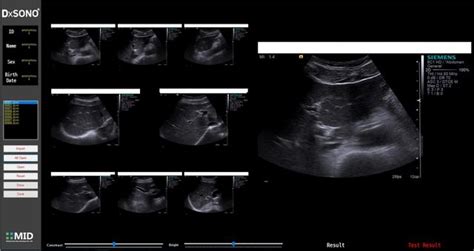 주메디칼이노베이션디벨로퍼의료영상 진단 보조 장치 Dxrad 기업정보 넥스트유니콘