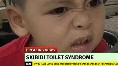 Skibidi Toilet Syndrome Breaking News Youtube