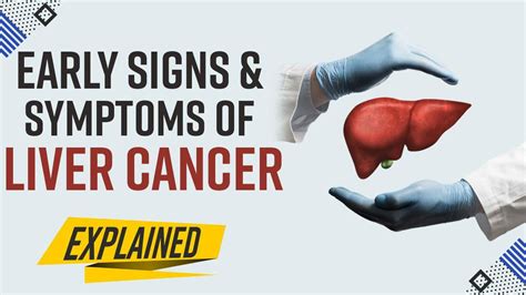 Liver Cancer Signs Symptoms And Treatments Available Expert Speaks