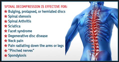 Five Benefits Of Spinal Decompression Franklin Chiropractor