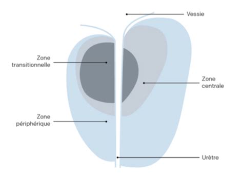Item Hypertrophie B Nigne De Prostate Cartes Quizlet
