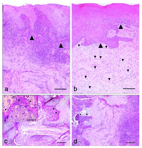 Histological Photomicrograph Of Hematoxylin And Eosin H E Stained