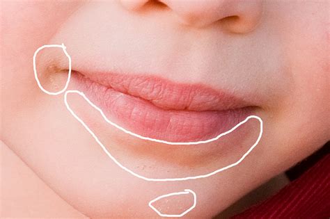 Free Download Program Dry Red Patch On Bottom Lip Nestprogs