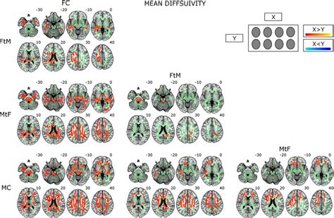 White Matter Microstructure In Transsexuals And Controls Investigated