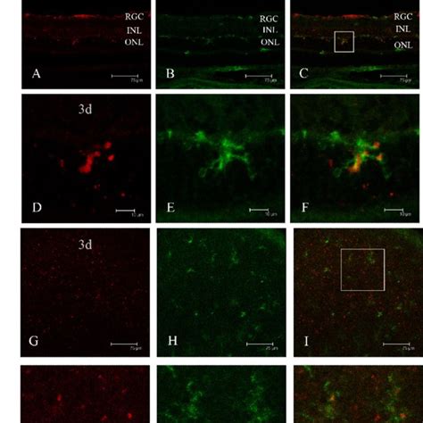 Western Blot Analysis Of CCL2 And CCR2 Expression After Extensive Light