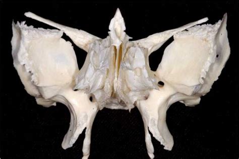 Ventral View Of Sphenoid And Ethmoid Bones Neuroanatomy The