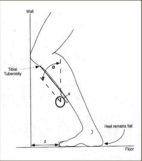 Knee Valgus (Valgus Collapse), Glute Medius Strengthening, Band Hip Abduction Exercises, and ...