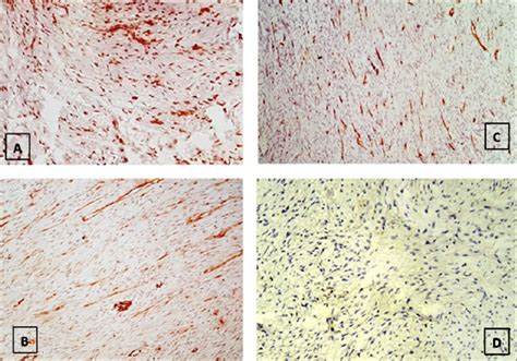 Immunohistochemical Staining Of A Beta Catenin Positive B Actin Download Scientific