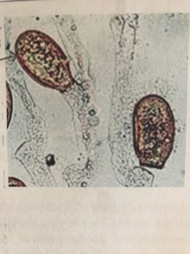 Lab 7 Fungi (Practical 2) Flashcards | Quizlet 