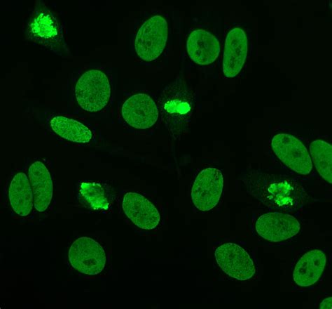 Fluorescent Antinuclear Antibody Fana Testing Pathology Student