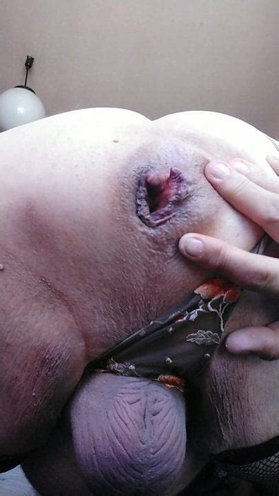 Lithuanian Gay Porn Videos With Men In Anal Sex XHamster