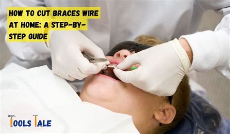 How To Cut Braces Wire At Home Top 9 Easy Steps