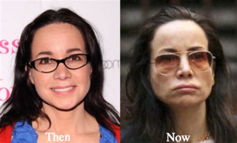 Janeane Garofalo Plastic Surgery Before and After Photos - Latest ...