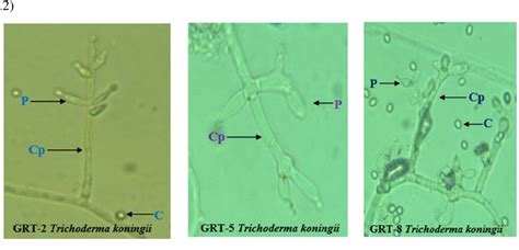 Figure 2 From IDENTIFICATION OF TRICHODERMA SPECIES BASED ON