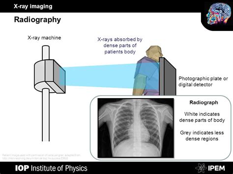 X Ray Machine Diagram