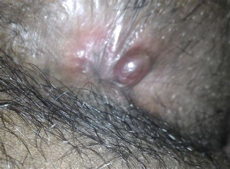 Girls Masturbating With Zits On Their Asses Naked Telegraph