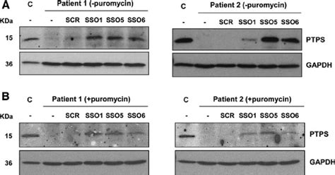 Ptps Protein Analysis In Patients Fibroblasts Western Blot Analysis