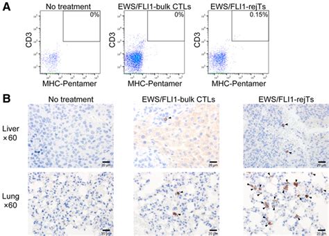 Biological and histopathologic distribution of EWS/FLI1-bulk CTLs and ... 