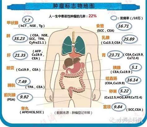 我体检时查出肿瘤标志物升高，就一定得了癌症吗？ 知乎