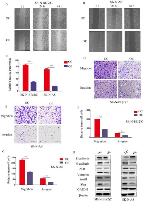 Meg Suppressed Nb Cell Migration And Invasion By Affecting Emt A B