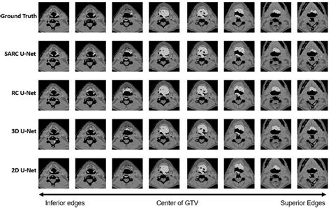 Diagnostics Free Full Text Deep Learning Architecture To Improve