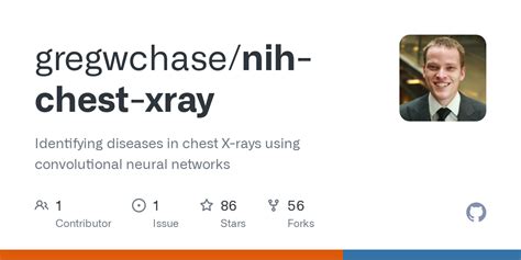 GitHub Gregwchase Nih Chest Xray Identifying Diseases In Chest X