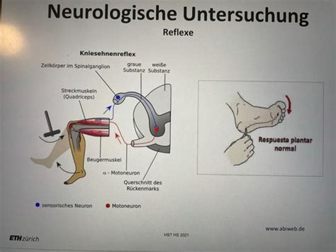 Kapitel Krankheiten Des Ns Flashcards Quizlet