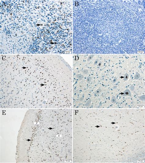 Immunohistochemical Staining Of Porcine Circovirus Type 2 Pcv2 Capsid