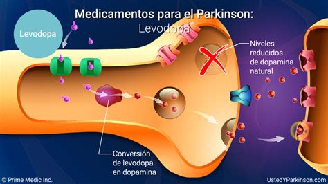 Tratamiento Y Manejo De La Enfermedad De Parkinson