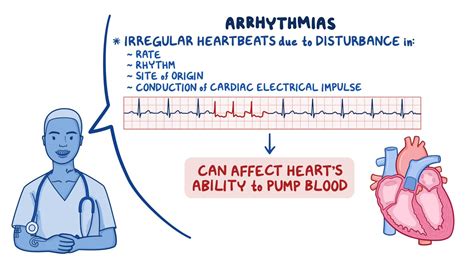 Ventricular Tachycardia Causes Symptoms And Diagnosis