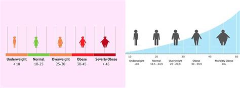 What is Morbid Obesity? - Op.Dr. Tufan Ergenç