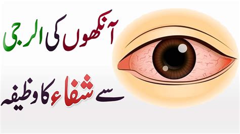 Ankho Ki Allergy Se Shifa Ka Wazifa Eye Allergy Ankhon Ki Bimarion