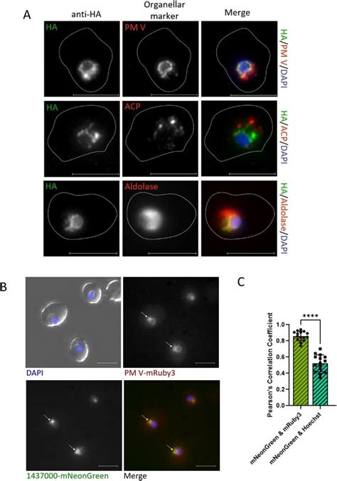 Pf3D7 1437000 Resides In The ER A Micrographs Of Immunofluorescence