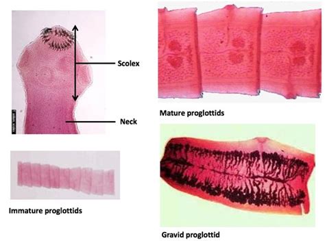 Taenia Mature Proglottid Label