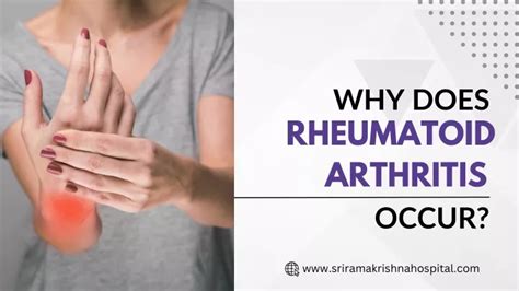 Ppt Why Does Rheumatoid Arthritis Occur Powerpoint Presentation Free Download Id 12498528