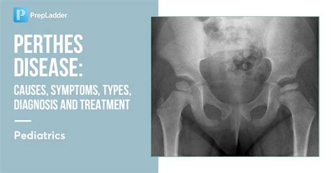 Perthes Disease: Causes, Symptoms, Risk Factors, Diagnosis