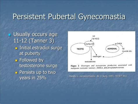 Ppt Gynecomastia Powerpoint Presentation Free Download Id 3336596