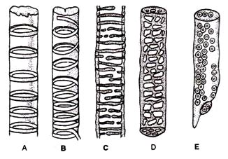 Simple Xylem Vessel Diagram