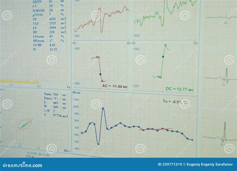 Electrocardiography Athlete Doing Cardiac Stress Test Ergometry Of