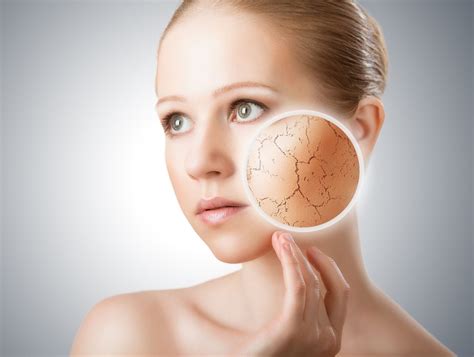 remedios caseros  la piel seca salud teu