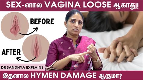 Pregnancy கக அபபறம 90 Women இத பணண மடறஙக Dr Sandhya Explains Loose Vagina