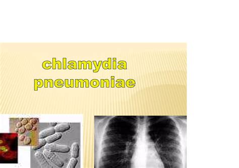 Chlamydia Bacteriologia Basica PPT