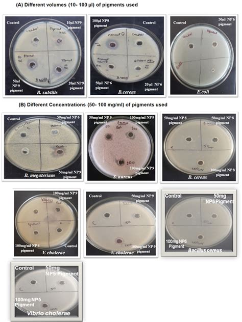 Antibacterial Activity Of Marine Bacterial Pigments Obtained From